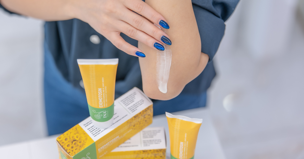 Jak odżywić skórę przy łuszczycy? Naturalny krem ziołowy