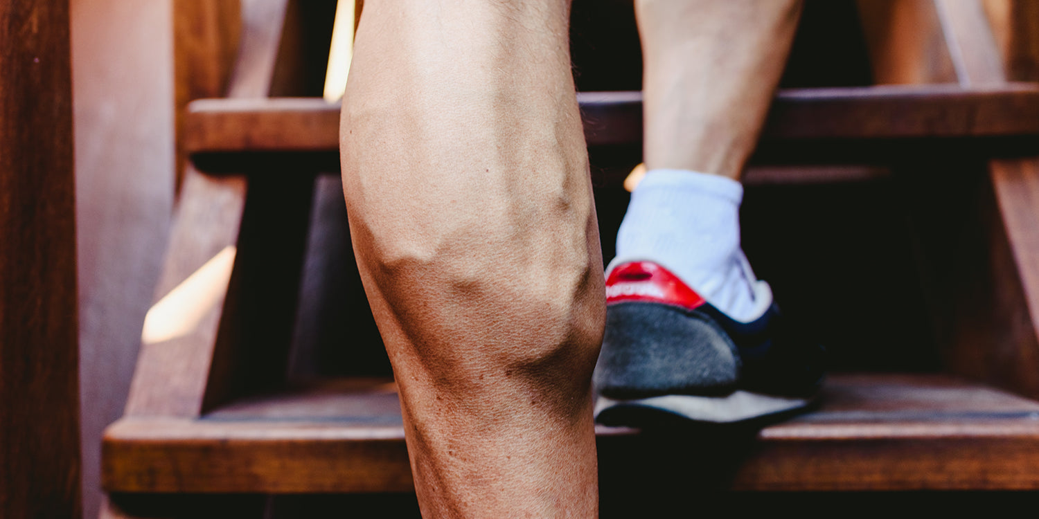 Żylaki na łydkach - jak zapobiegać podczas treningu fitness