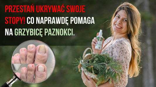 Sosna biała - Rozwiązanie na <strong>grzybicę paznokci, o którym nikt nie mówi