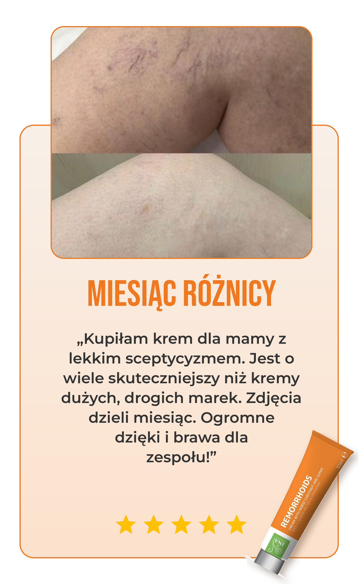 Opinia o kremie na żylaki 1