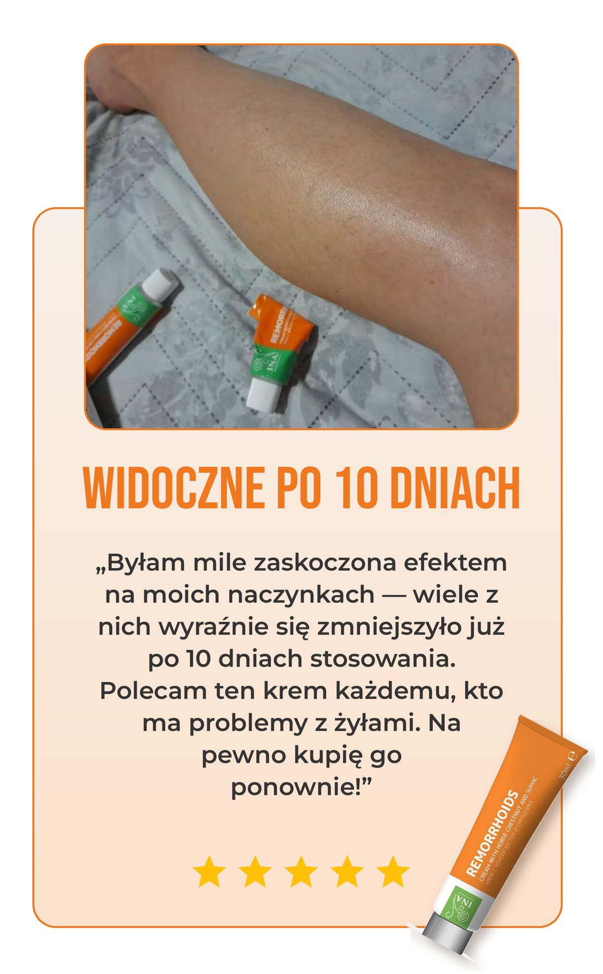 Opinia o kremie na żylaki 2