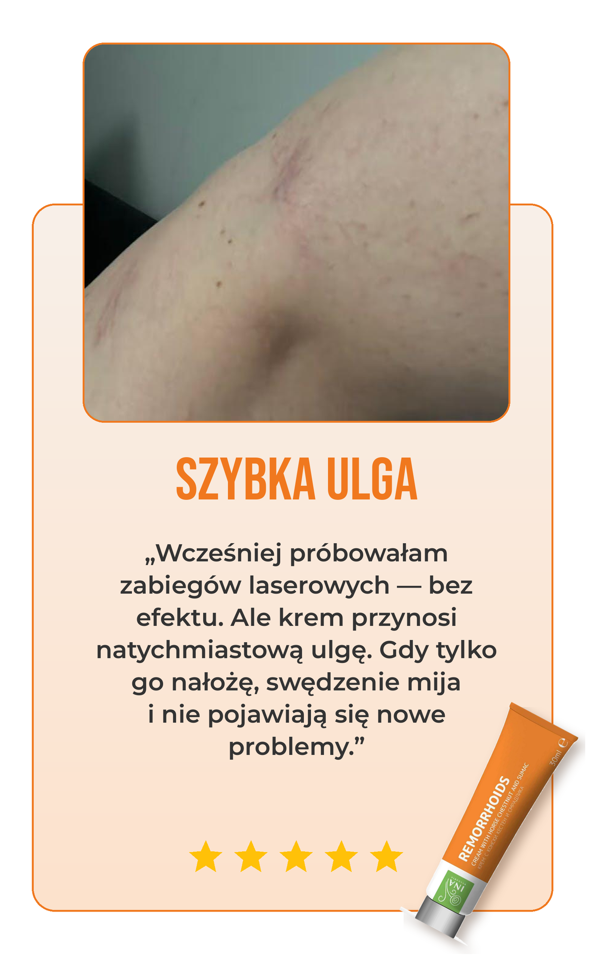 Opinia o kremie na żylaki 3
